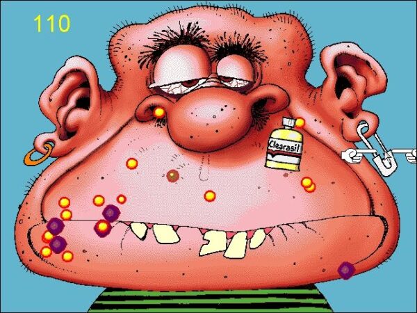 Acne Attack - Image 2
