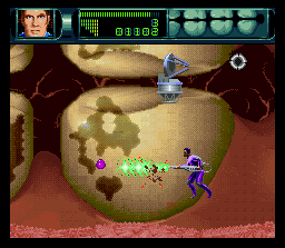 Rex Ronan: Experimental Surgeon - Image 4