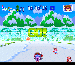 WakuWaku Ski Wonder Spur - Image 6